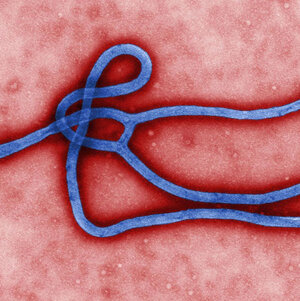 Outbreaks 2015: Protecting Americans From Infectious Diseases