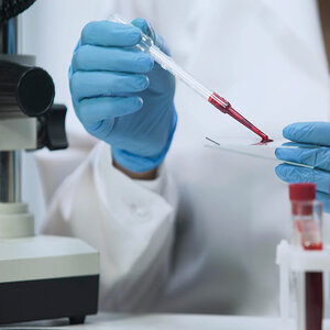 A researcher with a blood sample. A researcher with a blood sample.