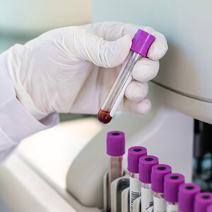 A closeup of a lab technician’s gloved hand holding a vial. A closeup of a lab technician’s gloved hand holding a vial.