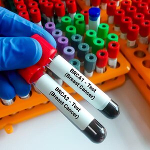 Vials of blood for testing.