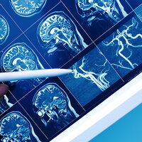 Michael J. Fox Foundation awards $6 million to Lario Therapeutics Michael J. Fox Foundation awards $6 million to Lario Therapeutics