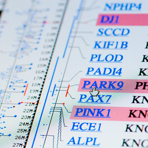 A computer readout of a genetic test highlighting a gene linked to Parkinson’s disease. A computer readout of a genetic test highlighting a gene linked to Parkinson’s disease.
