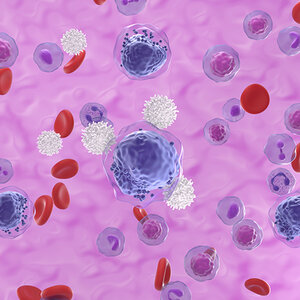 MMRF awards $21 million for multiple myeloma research networks