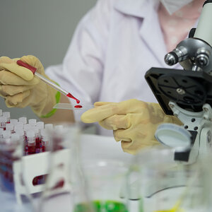 Blood tests being done in a lab.