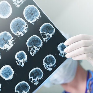 UTMB-Galveston receives $25 million for brain health institute UTMB-Galveston receives $25 million for brain health institute