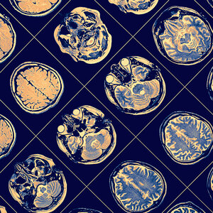 A brain scan. A brain scan.