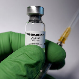 Wellcome, Gates Foundation award $550 million for tuberculosis vaccine